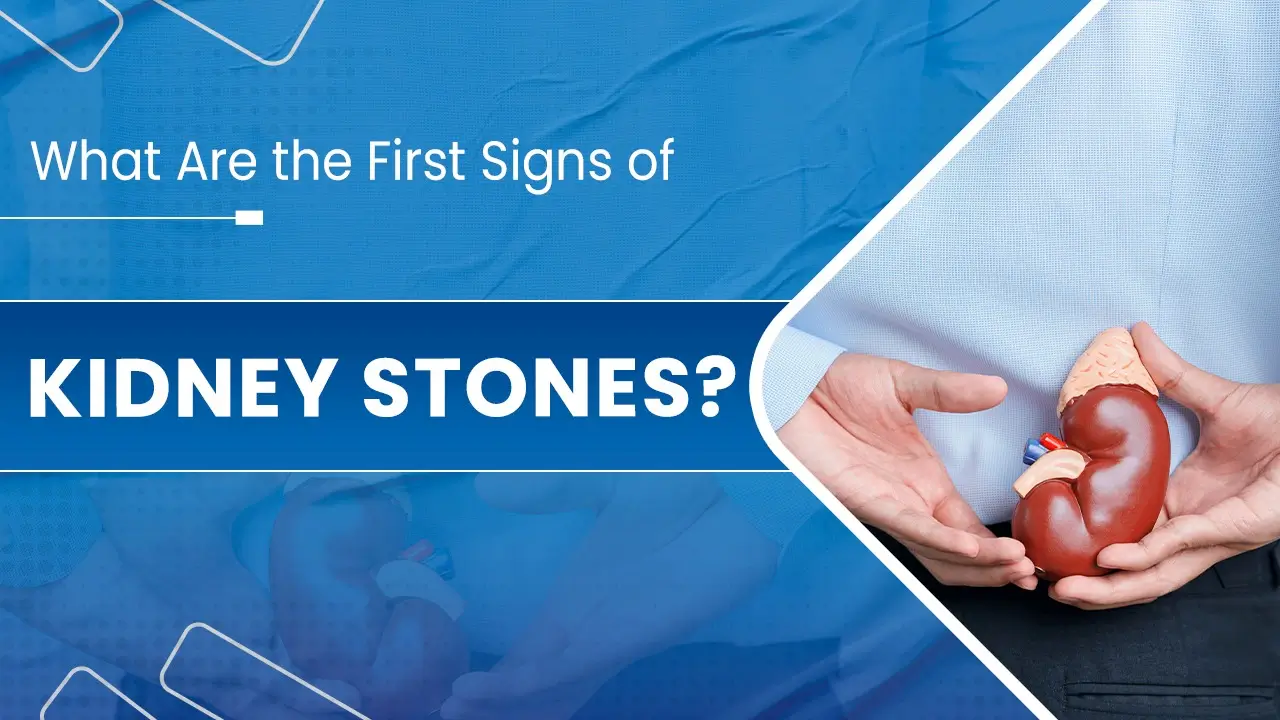 What Are the First Signs of Kidney Stones?
