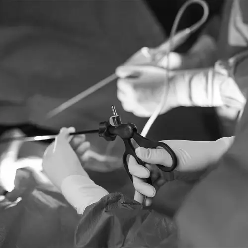 Robotic Surgery in mohali