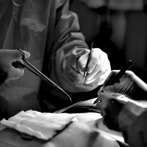 Robotic treatment in chandigarh