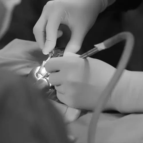 Robotic treatment in mohali